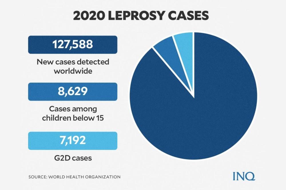 What is Leprosy, Really? Olney Theatre Center